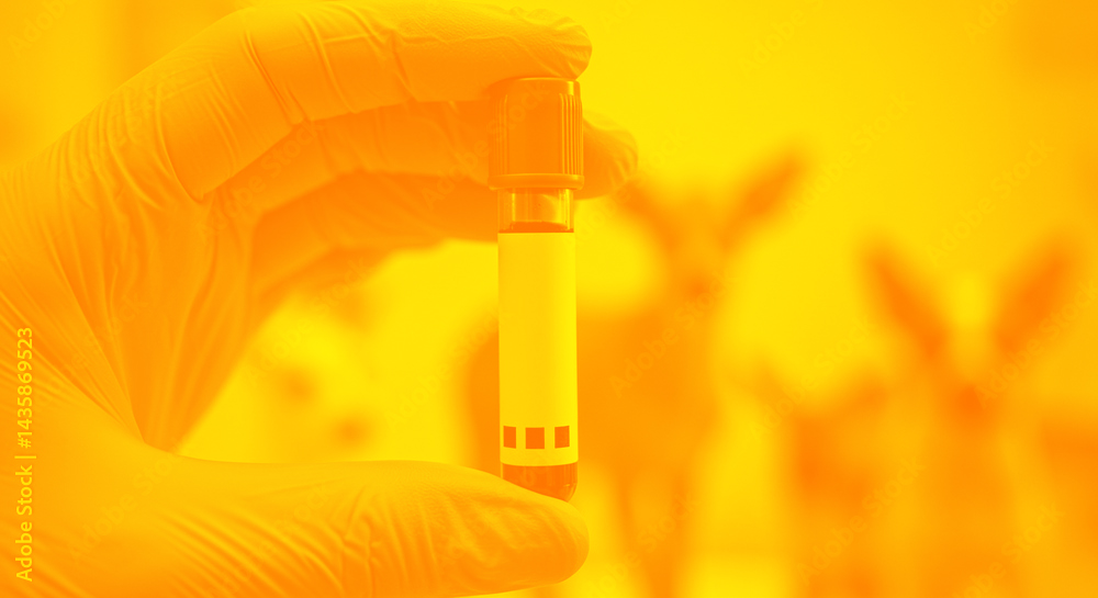 Blood Tests