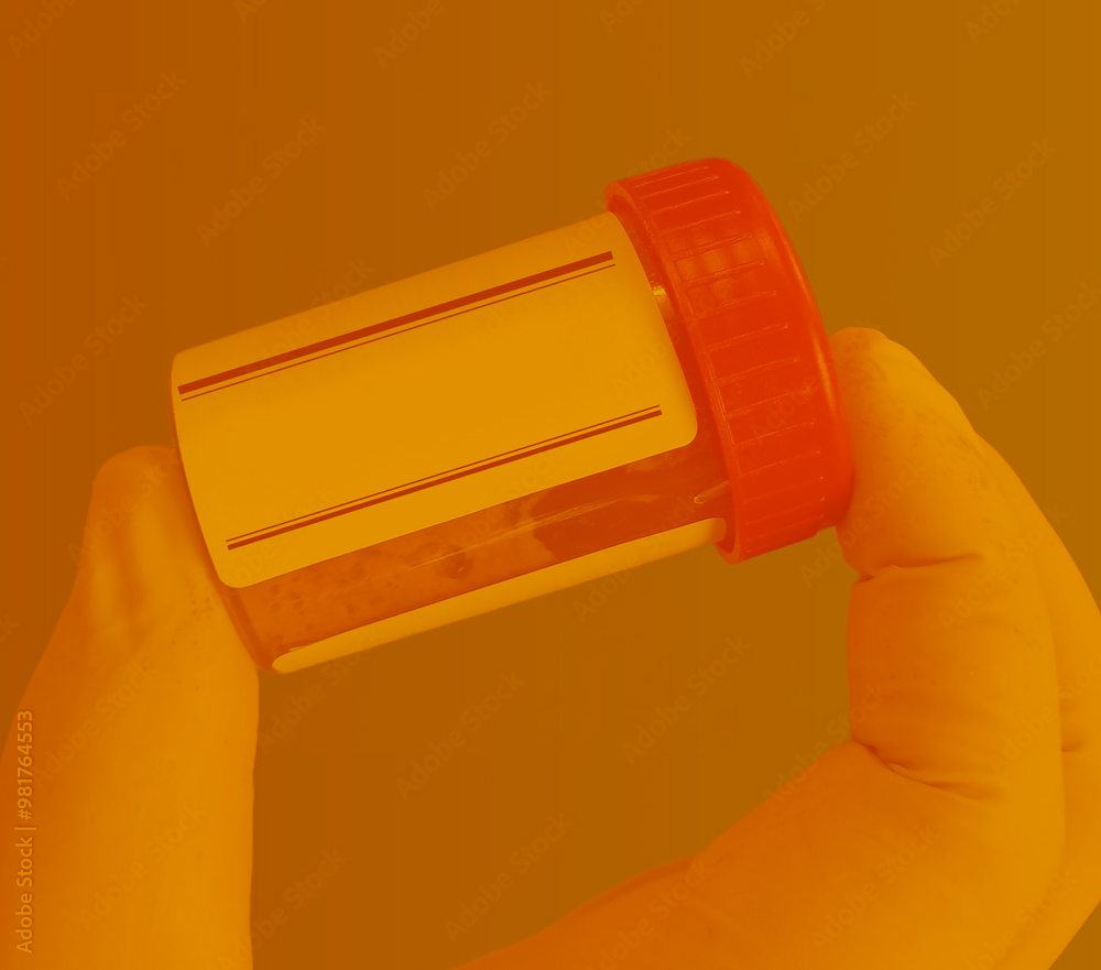 Faecal Tests
