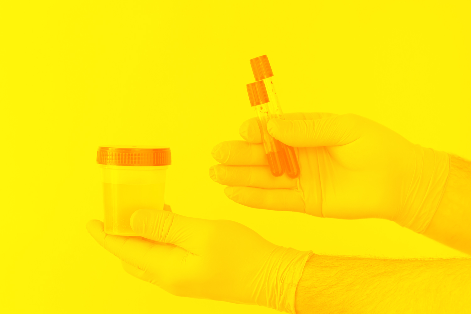 Urine Tests